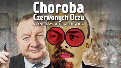 Choroba czerwonych oczu, czyli zazdrość